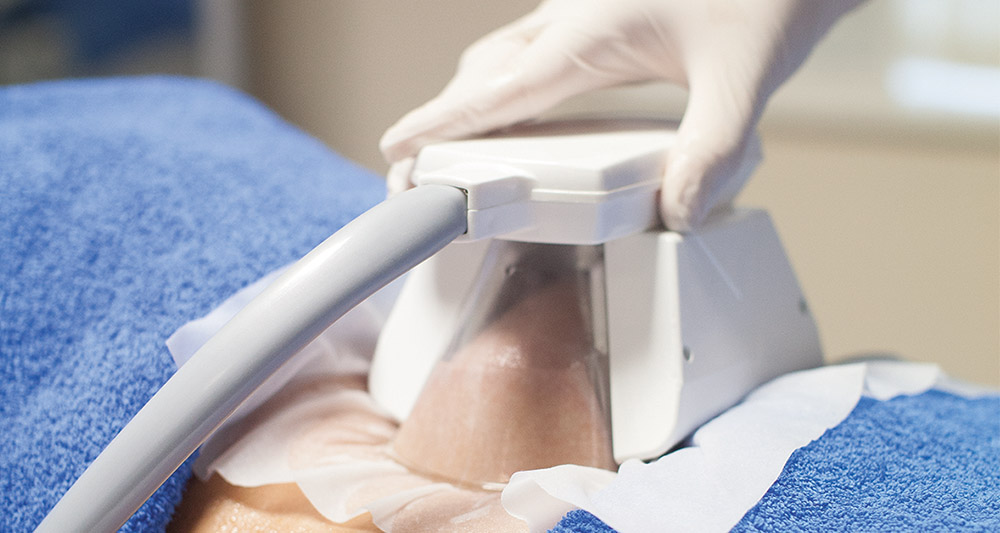 How Fat Freezing and HIFU Work Together? 2 Multiple Areas in One Session HIFU and Fat Freezing Oxfordshire