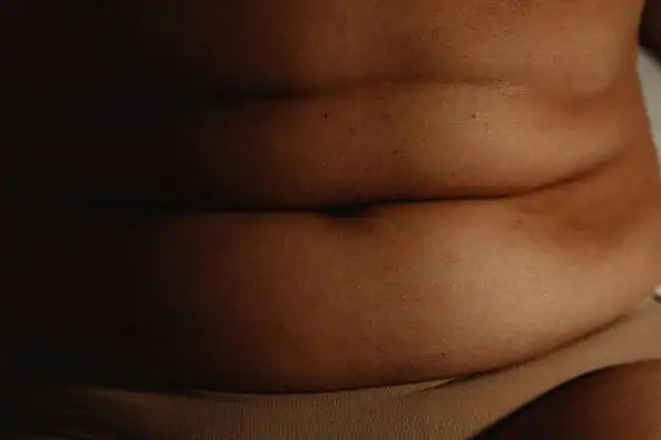 The Hidden Connection: How Stress Shapes Your Fitness and Body Composition 3 image of what stress can do on the stomach area and how Lipo 360 Oxfordshire can help to change your body shape.